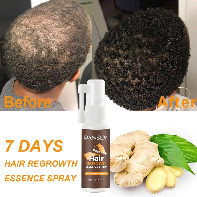 Black Rice Hair Growth Spray Repairs damage restore 5