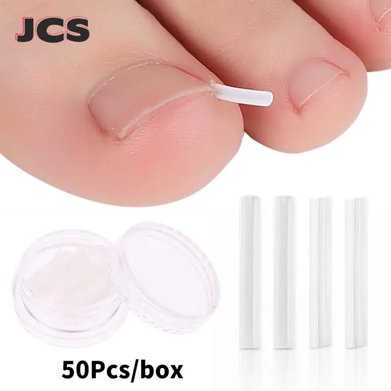 

50 шт. инструмент для коррекции вросших ногтей, лечение вросших ногтей, наклейка, зажим для выпрямления, инструмент для педикюра