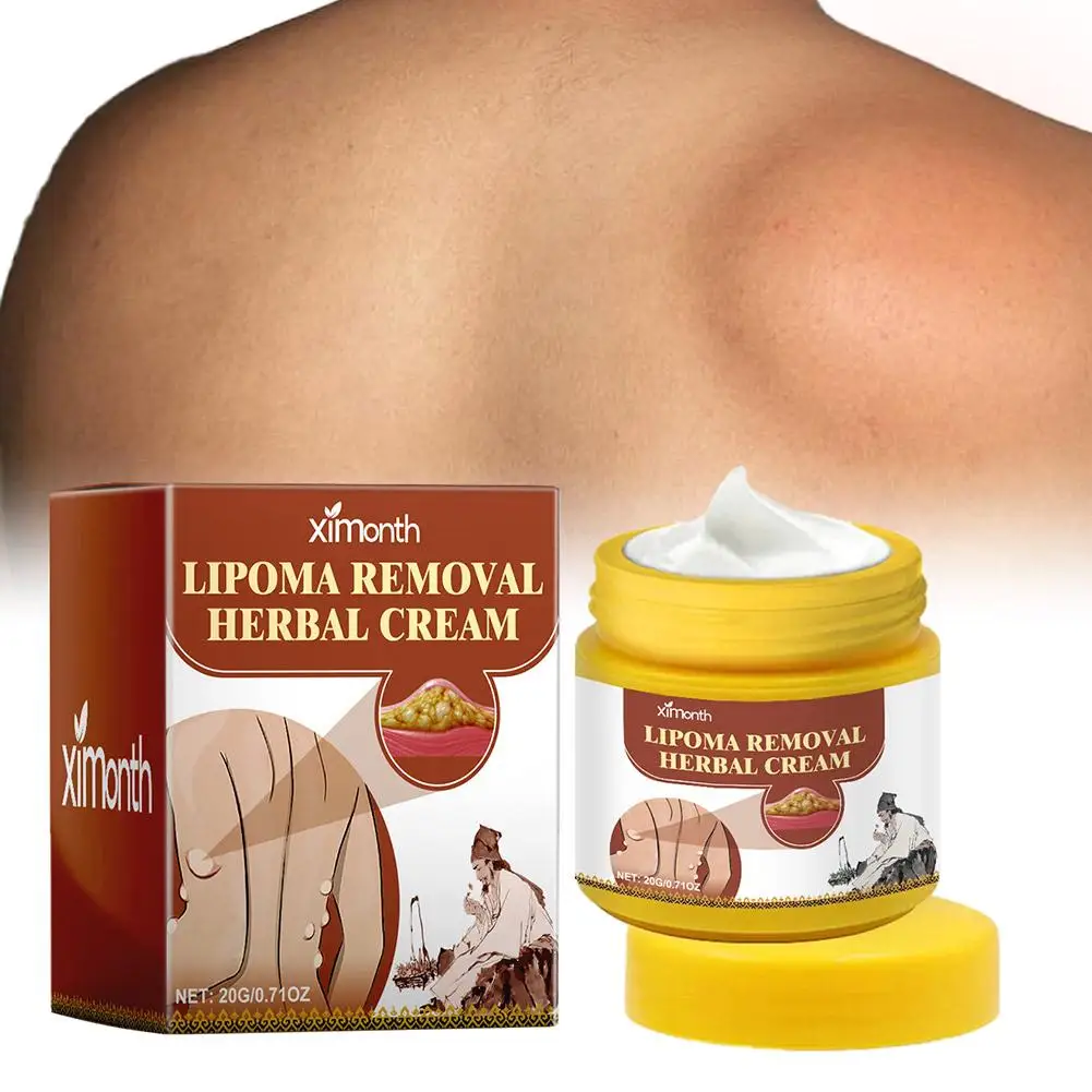 1pc Lipoma Removal Herbal Cream Body Cream Dissolving Fat Easy To Use Herbal Lipoma Removal Cream - Image 4