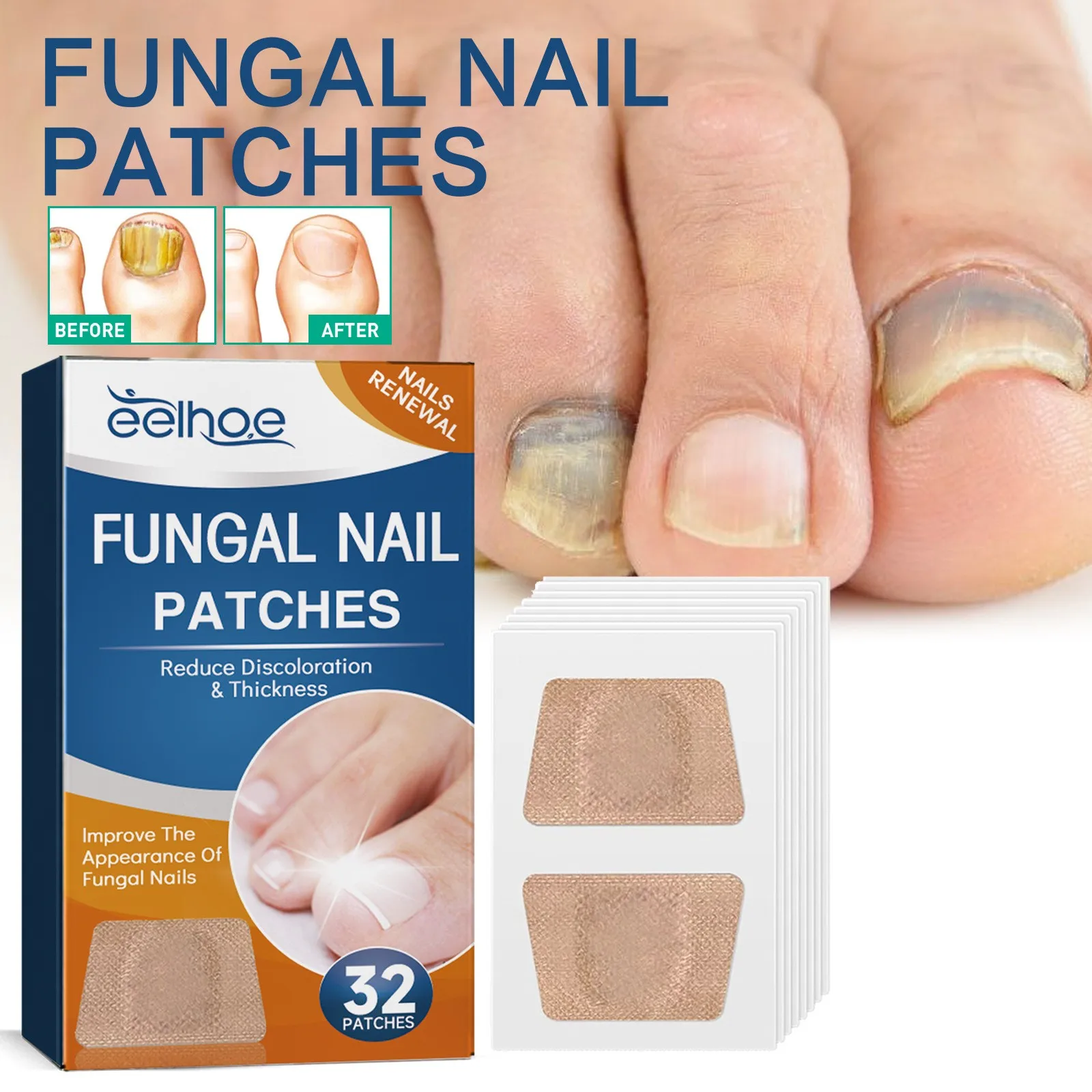 Ingrown Toenail Correction Tool Manicure Pedicure Tool Set Foot Care Tool Foot Pedicure Tool Foot Care Patches Toenail Fungus Patch Nail Repair 32/64PCS Paronychia Treatment Patch Fungus Removal Nail Ingrown Correction Stickers Nails Recover Pedicure Tools Health Care