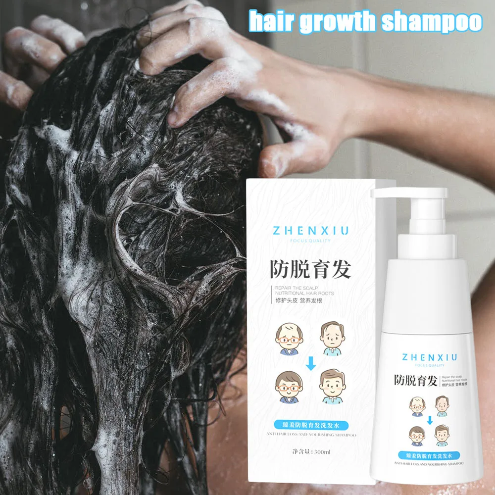 Hair Growth Shampoo Herbs Anti Hair Loss to Make Hair Thicker And Longer Hair Growth Hairline Treatment Hair Care Product 300Ml