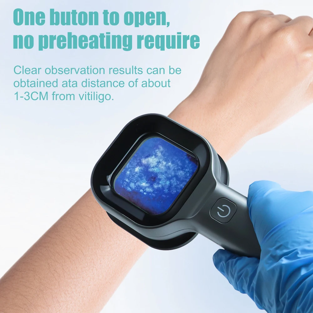 365nm Wood Lamp Detector 6