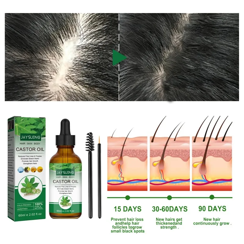 Description Picture 4 of itemHair Thickening Castor Oil for Hair Growth Treatment Preventing Baldness Anti Hair Loss Roots Shining Nourishing Enhancing Care