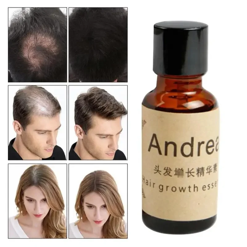 20ml Huile Essentielle Essential Oils Andrea Hair Growth Loss Liquid Grow Restoration Pilatory Dense Fast Sunburst andrea ginger extract dense hair fast sunburst hair growth essence restoration hair loss liquid serum hair care oil