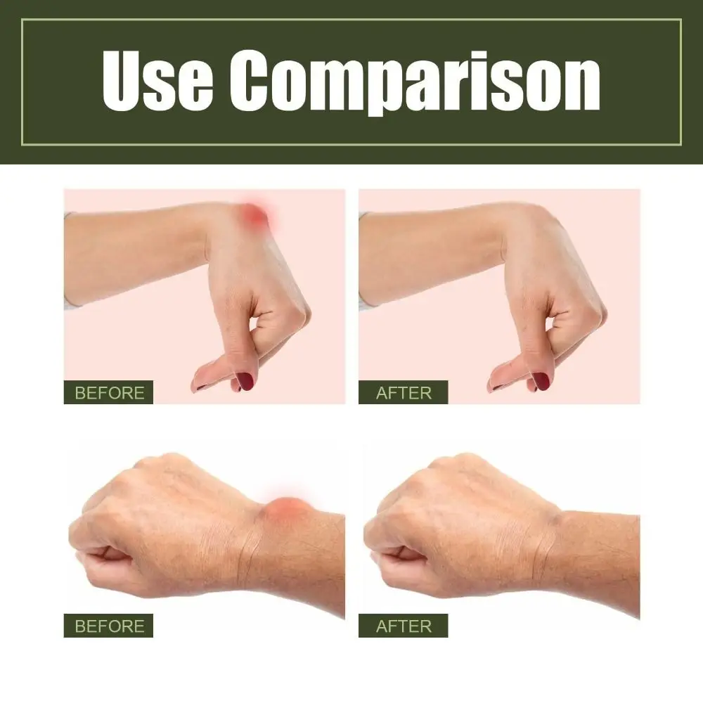 Health Tendinous Sheath Type Foot Care Tenosynovitis Cold Compress Gel Pain Spray Tendon Sheath Pain Joint Spray 2 PCS foot care spray