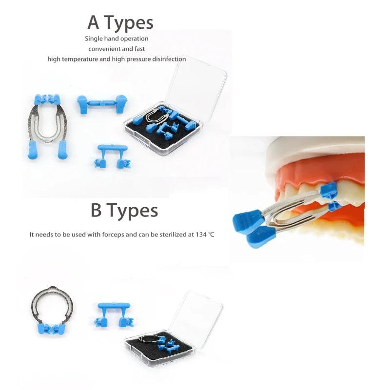

Dental Matrix Ring Sectional Contoured Metal Spring Clip Teeth Replacement A/B type Dentist Matrix Ring Dentist Instrument Tools