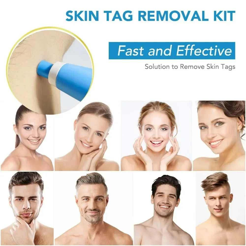 2 In1 Painless Auto Skin Tag Mole Wart Removal Kit Cleaning Tools Face Skin Care Body Wart Dot Treatments Remover Beauty Health 3