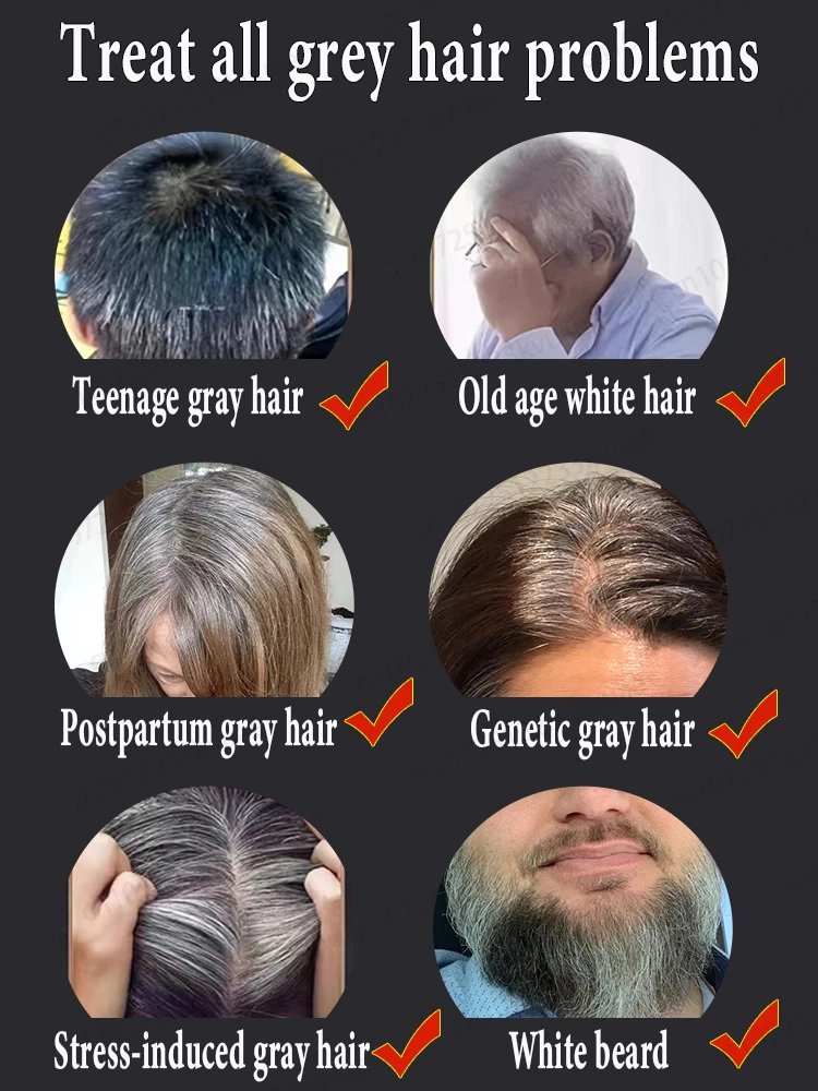 Hair Color Restorer White Hair Killer Used to turn white hair into black hair Nourish the scalp Suitable for white hair essence Repair care