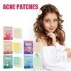 144 PCS/SET Star Pimple Patch Acne Colorful Invisible Acne Removal Skin Care Stickers Concealer Face Spot Beauty Makeup Tools 3