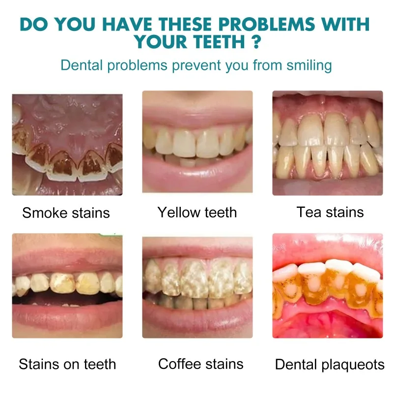 Eelhoe Teeth Whitening Essence image 9