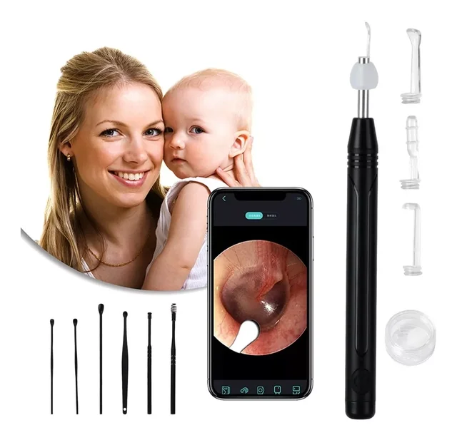 [알리익스프레스] 귀 청소 키트 스마트 카메라 무선 내시경: 귀와 그 이상을 위한 완벽한 해결책