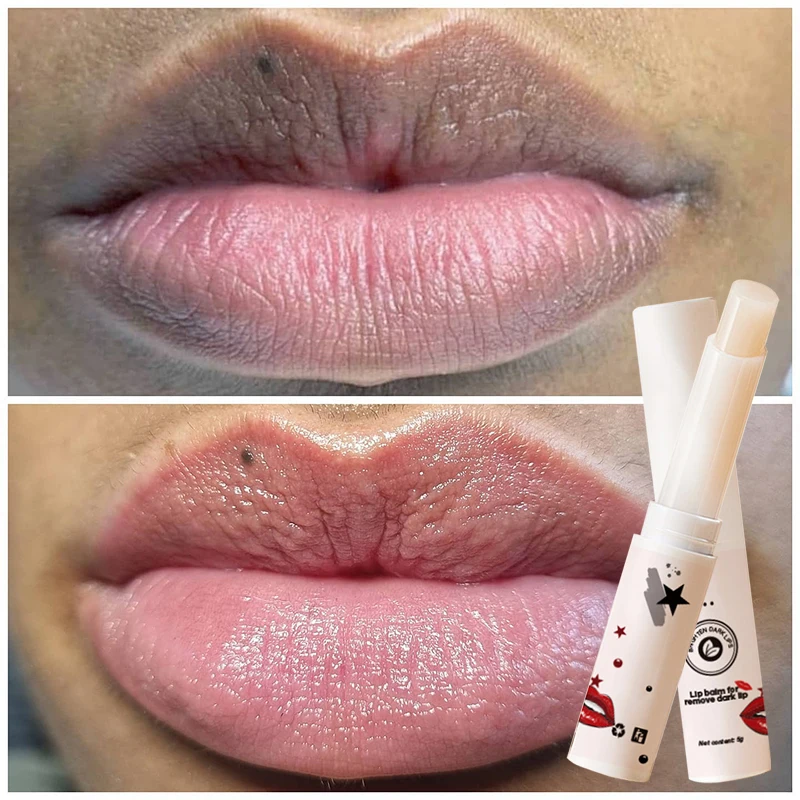 BlackLipLighteningLipBalmRemoveDullBlackLipProductsNourish