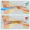 Ear Cleaner Irrigation Kit Ear Wax Removal Tool Water Washing Syringe Comfortable Unique 12/20ML Health Care 5