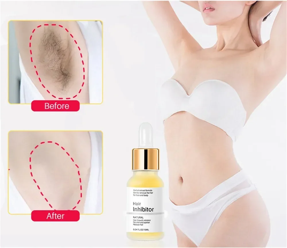 Hair Remover Cream Inhibition Hair Growth Permanant Removal Inhibitor Beard Bikini Intimate Legs Body Armpit Painless Remover