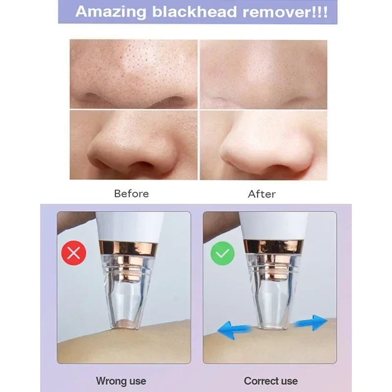 Electric Blackhead Remover Vacuum Pore Cleaning 10 Bux or Less