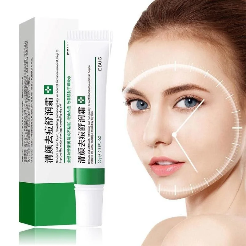 Acne Removal Cream Freckle Cream Shrink Pores Whitening Moisturizing
