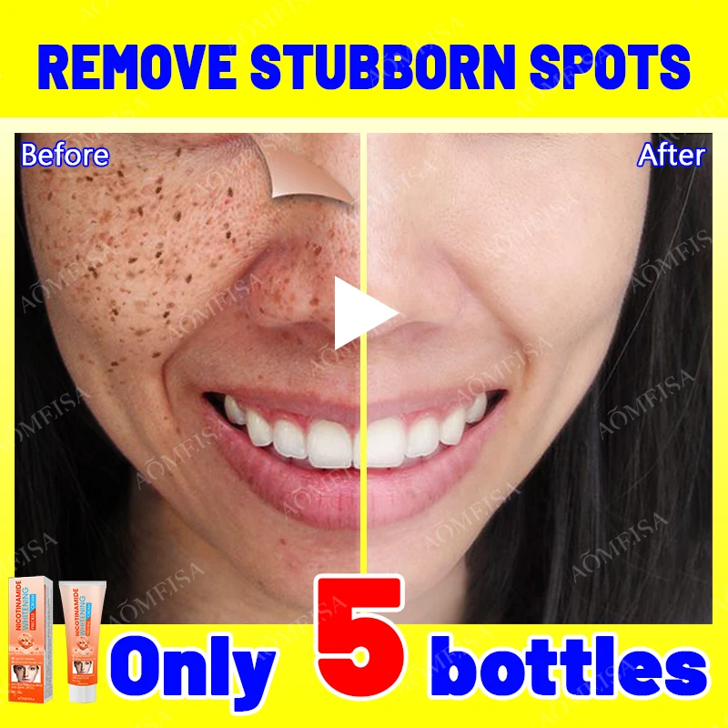 SpotRemovalEssenceRemoveFacialSpotsSkinDarkSpotsRemove