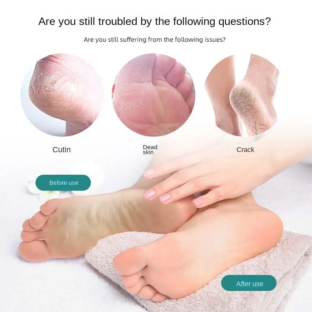 Description Picture 6 of itemCallus Dead Skin Remover Nano Glass Pedicure Tool Pedicure Rasps Foot Care Tools Nano Glass Foot File Foot Scrubber