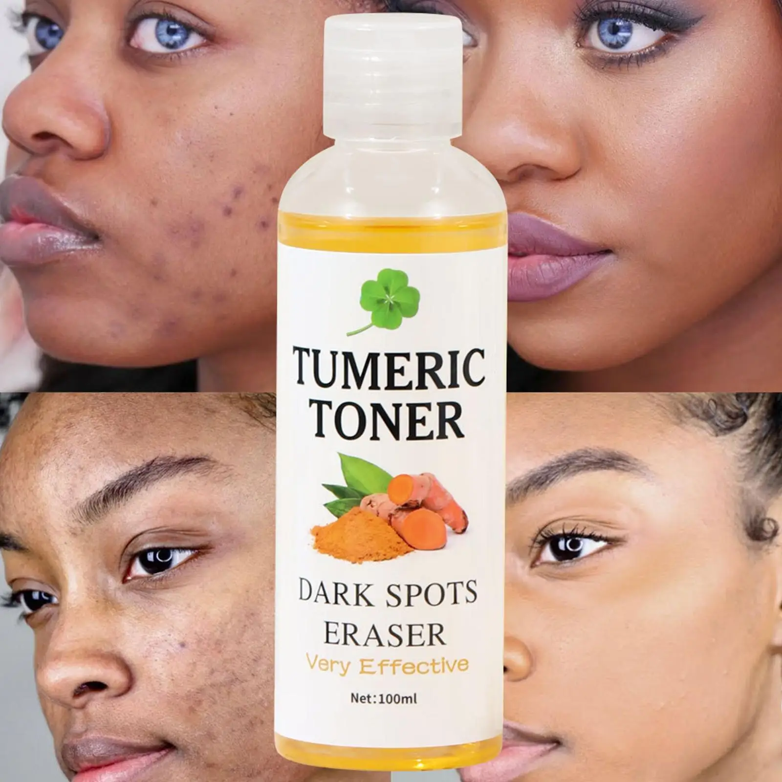 100ml Tumeric Dark Spots Toner Eraser Corrector Turmeric Blemishes Toner Fade Remover Dark Moisturizing Brightening Skin Care