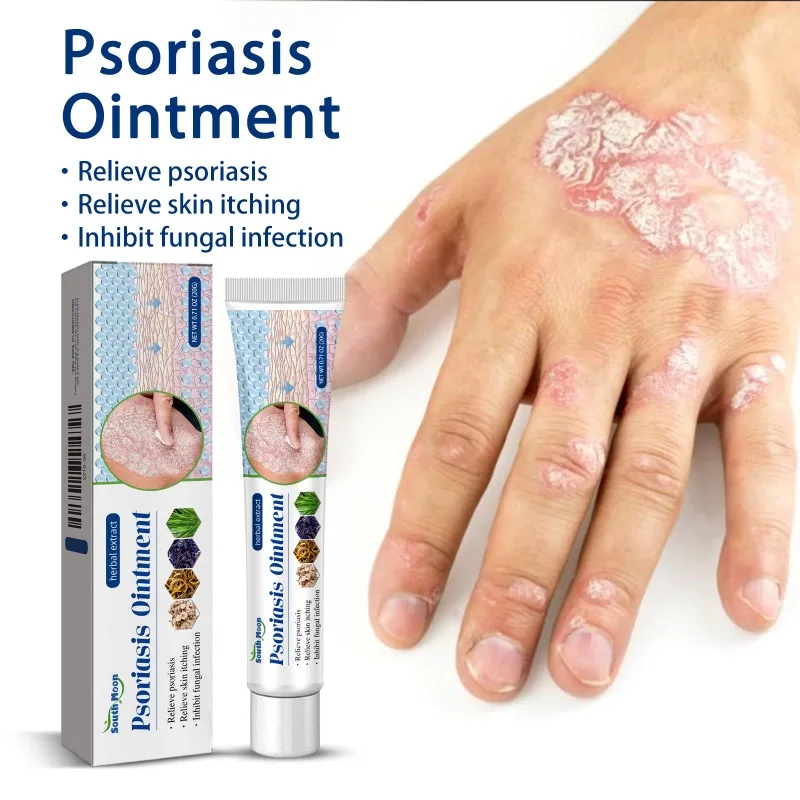 Psoriasis Ointment Anti-Itching Skin Repair Problems Treatment Eczema Dermatitis Antifungal Topical Body Care Essence Ointment