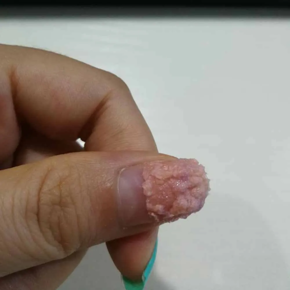 thumb