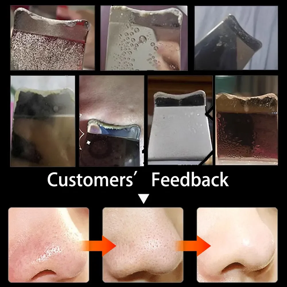 Ultrasonic Skin Scraper Pore Deep Face Cleaning Remover Blackheads Skin Care Spatula Shovel Cleanser with Vibration Massage 3