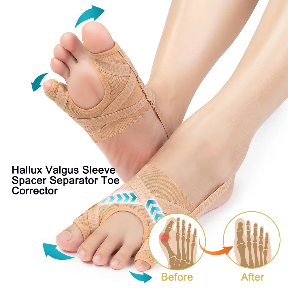 Hallux Valgus Bunion Corrector Big Toes Separators Splint Feet Straightener Bone Thumb Foot Care Tools Bunion Socks Running