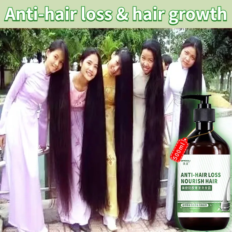 

500ml Natural Ginger Hair Loss Shampoo Anti Dandruff Promotes Hair Growth Thicker Nourishes Hair Stimulates Refreshe Oil Control