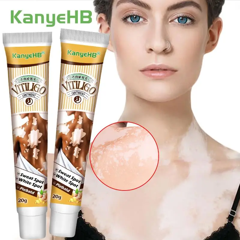 

2Pcs Effectively Remove Vitiligo Ointment Remove Ringworm White Spot Removal Skin Vitiligo Eliminate Vitiligo Skin Care A1741