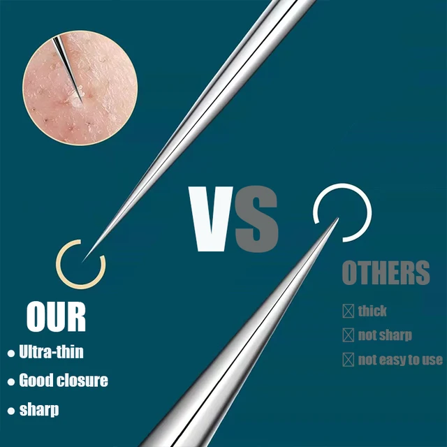 Achieve flawless skin with the Blackhead Remover Squeeze Acne Needle Tweezers by OULANWAN.