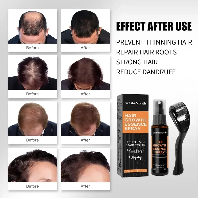 Hair Growth Care Ginger Polygonum Multiflorum Anti-Hair Loss Hair Care Essence Oil Unisex Fast Growth Thick Spray