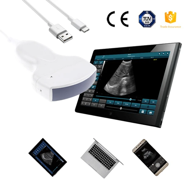 Samsung Ultrasound China Trade,Buy China Direct From Samsung Ultrasound  Factories at