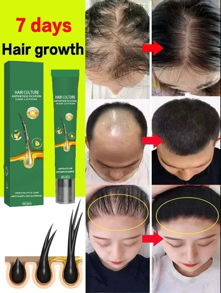 Successful products, 99% of buyers will buy again, they have more and more hair, say alpha baldness, thick hair