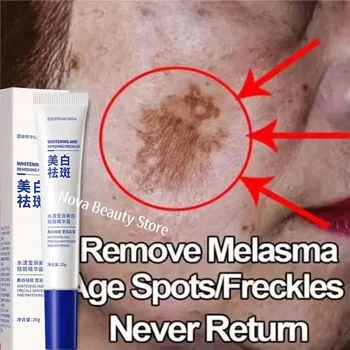 Potente crema sbiancante per la rimozione delle macchie Illumina la pelle Elimina rapidamente la pigmentazione della melanina Melasma Macchie scure Cura della pelle del viso coreana