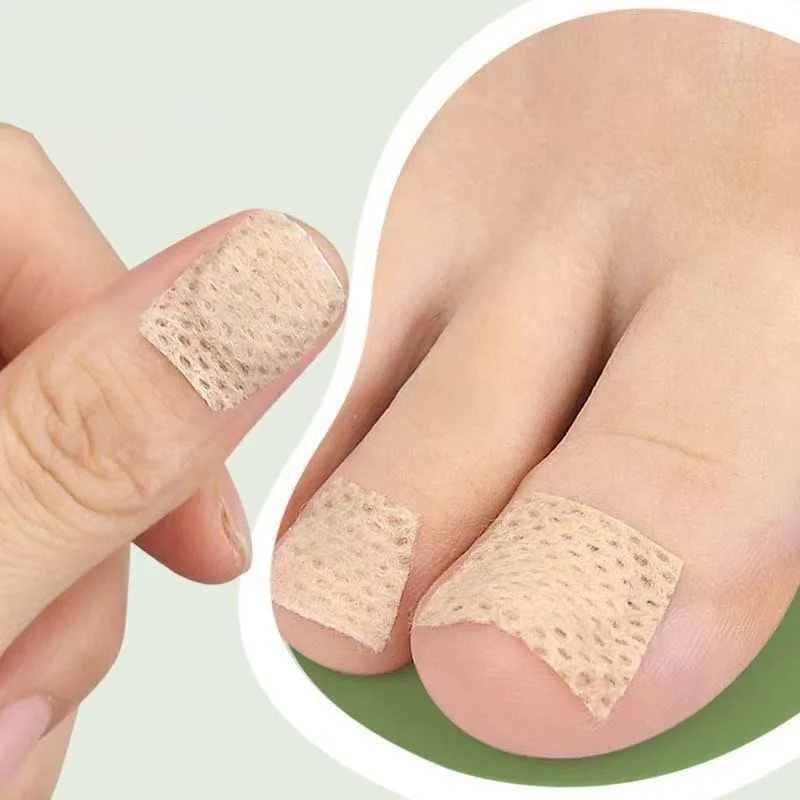 Fabric Ingrown Toenail Correction Stickers for Foot Health Care