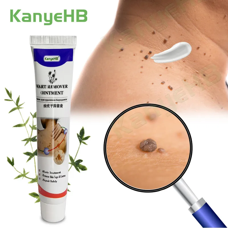 

Skin Tag Remover Cream Warts & Freckle Moles Treatment Ointment Dark Spot Herpes Papillomas Painless Wipe Off Gel Pen Skin Care