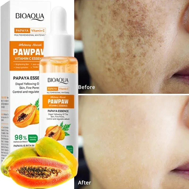 Papaya VC Brightening Serum Improve Dullness Remove Dark Spots Effective Whiten Freckle Product Moisturize Face Skin Care Beauty