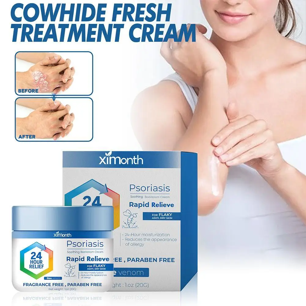 

20g Psoriasi Bacteriostasis Antipruritic Ointment Massage Eczema Dermatitis Rash Treatment Skin Health Care Plaster