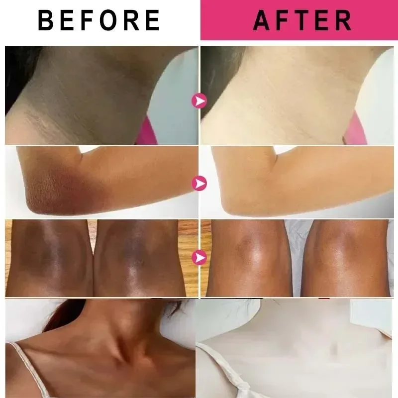 Brightening and Unifying Skin Tone Body Lotion Snow Bleach Cream Dark Spot Corrector Cream Skin Lightening Cream  Care Product 3