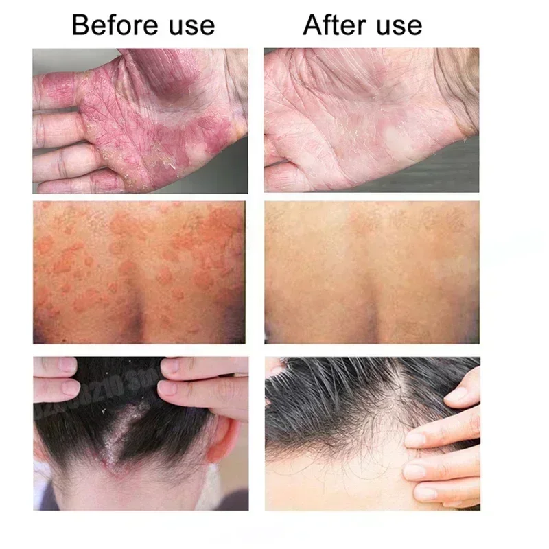 Massage Relaxation Gel Cold Compress Gel Relieve Muscle and Joint Pain Body Care Massage Cream