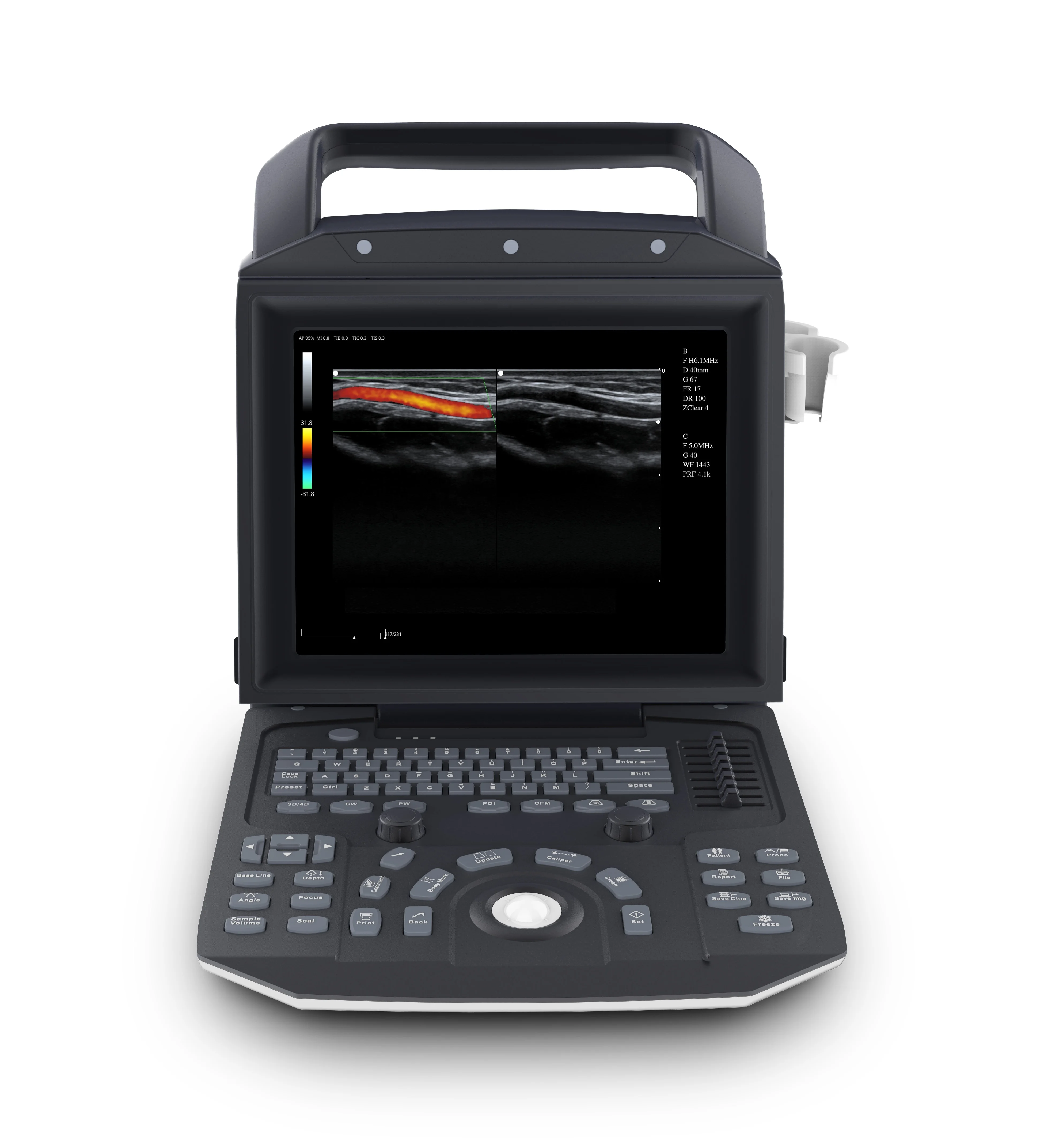Zoncare Ecografo 3D Ecografo 4D Color Doppler Ultrasuoni Prezzo Color Doppler Ultrasuoni Macchina Ad Ultrasuoni Colore