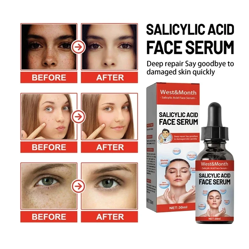 Niacinamide Facial Serum Salicylic Acid Moisturizing Skin Care Products 2024 3