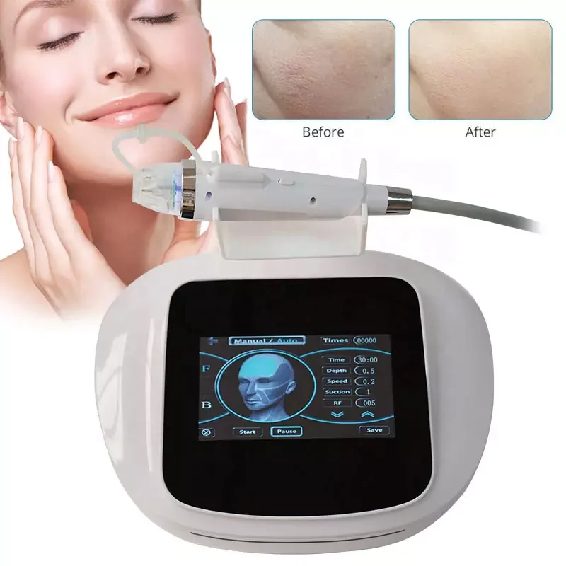 High-End portátil RF Facial beleza equipamentos, radiofrequência, fracionário R-f cristal máquina, estiramento, remoção de acne, 2023