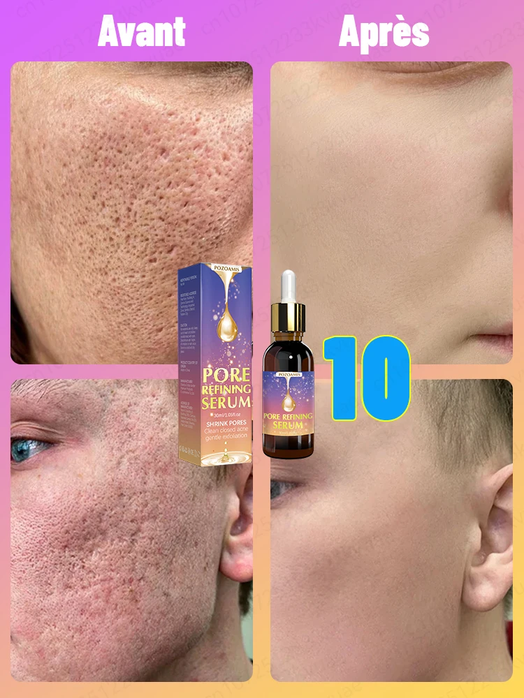 Pore shrinking essence, lighten pores, remove wrinkles, and restore 18-year-old skin