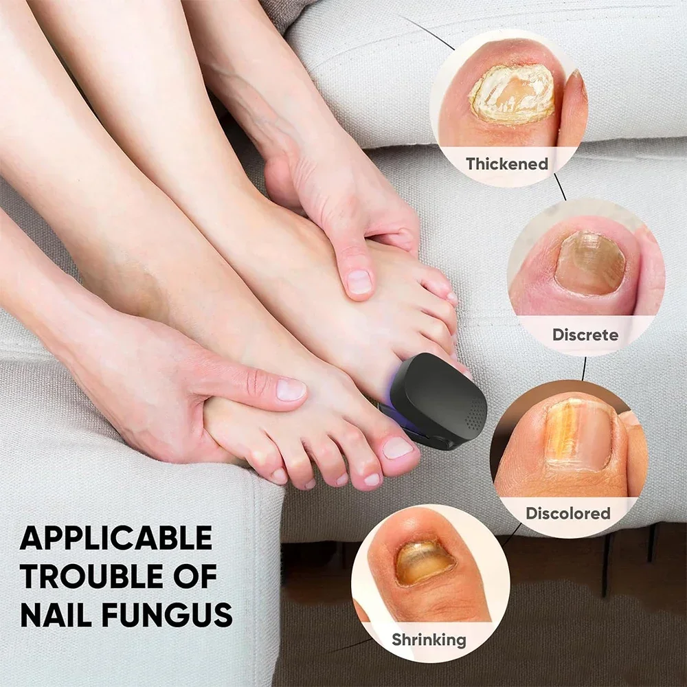 Nail fungus treatment LED laser device cleaning onychomycosis USB charge 905nm infrared 470nm blue light nail salon