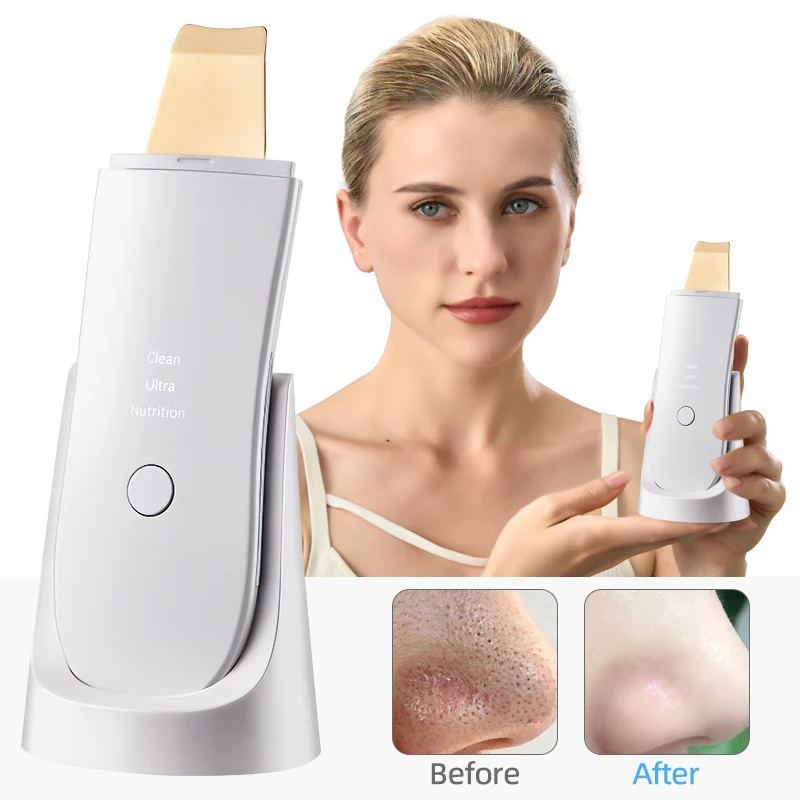 Skin Care Ultrasonic washing machine vibration shaving shovel blackhead removal shovel clean holes remove dead facial lifting