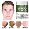 Crème anti-acné efficace, traitement, cicatrice d'acné, rétrécissement des Pores, contrôle du sébum, blanchiment, hydratation du visage, Ginseng, herbes, soins pour la peau