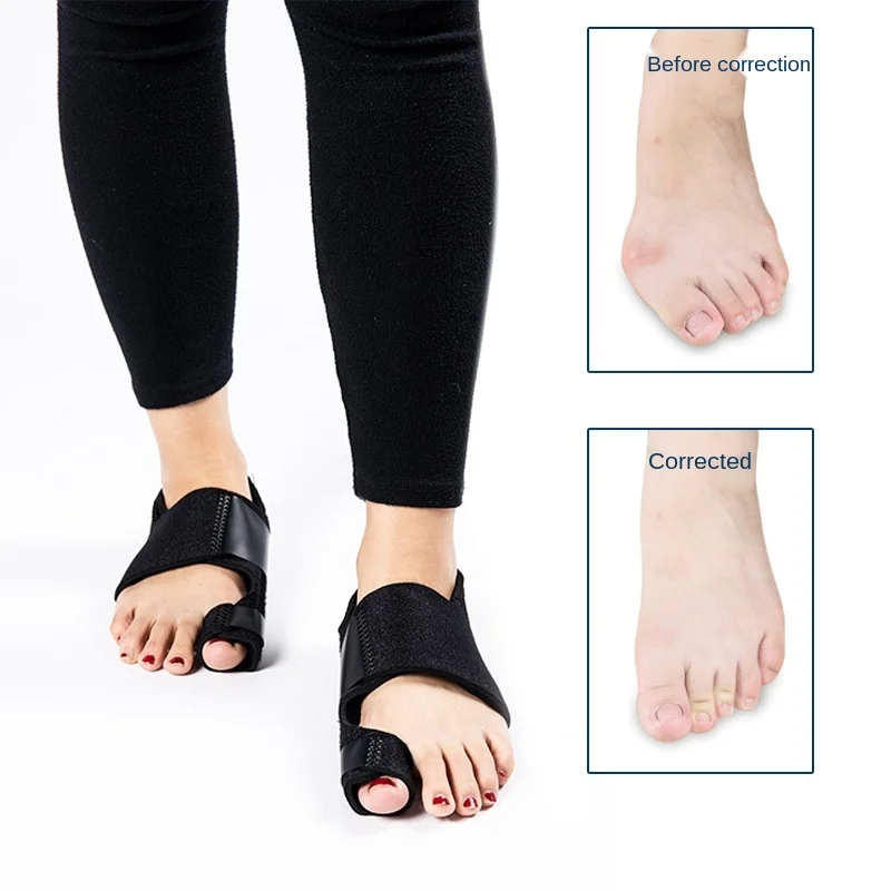 Ортопедический корректор вальгусной деформации большого пальца ноги | Красота и