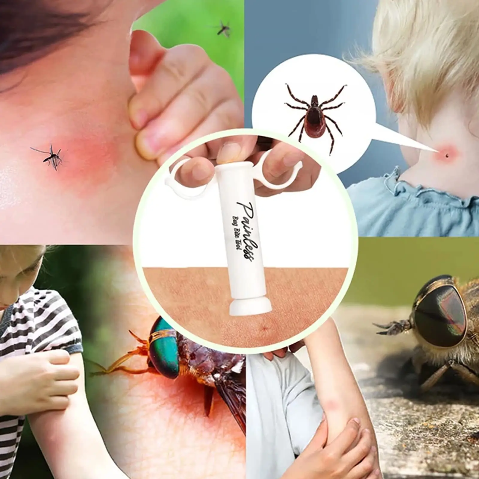 Outdoor Emergency Bee Wasp Bed Bug Sting Sucker Natural Detox First Aid Safety Tool Insect Sting Sucker Safety Emergency Tool insect sting sucker