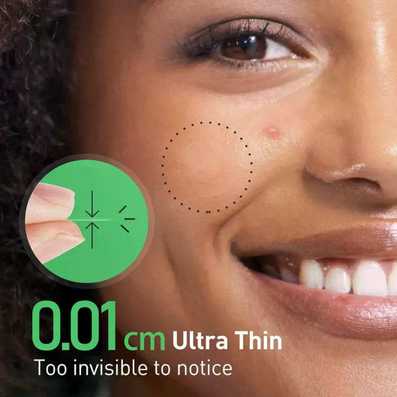 Hydrocolloid Invisible Acne Patch - Fade Acne Suction Pus Removal Stickers For Face Nose Body Skin Care Blemish Treatment Patche